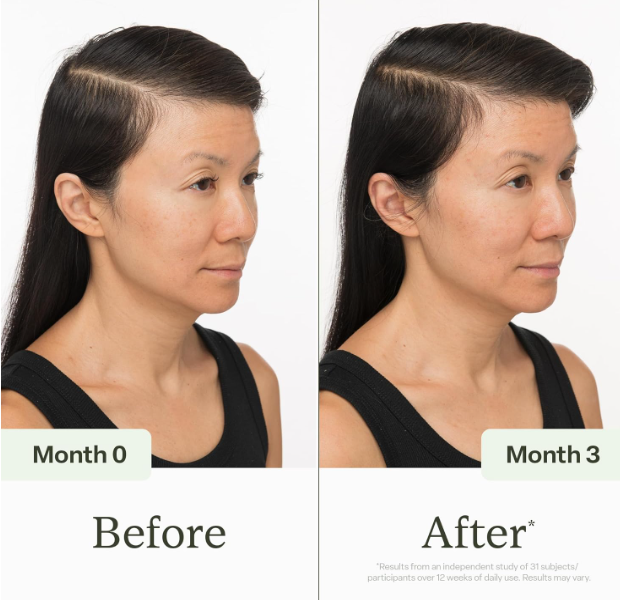 Divi Scalp Serum para Cabello Fino | Aminoacidos, Cafeina y Aceite de Romero